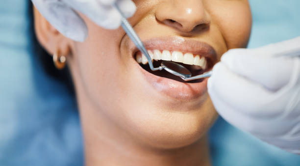 Best Emergency Wisdom Teeth Removal in Poynette, WI