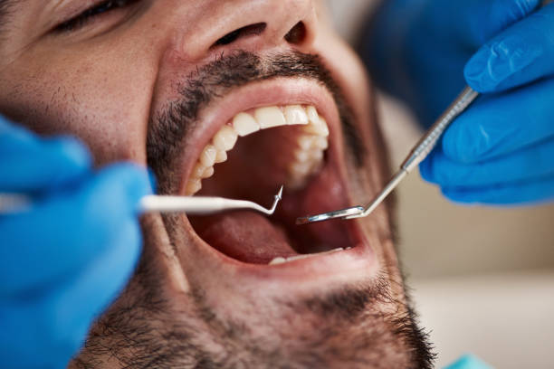Best Emergency Broken Tooth Repair in Poynette, WI